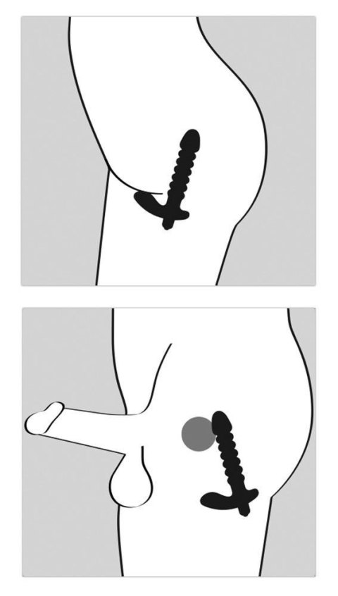 Plug/prostata-Black Velvets Vibrat